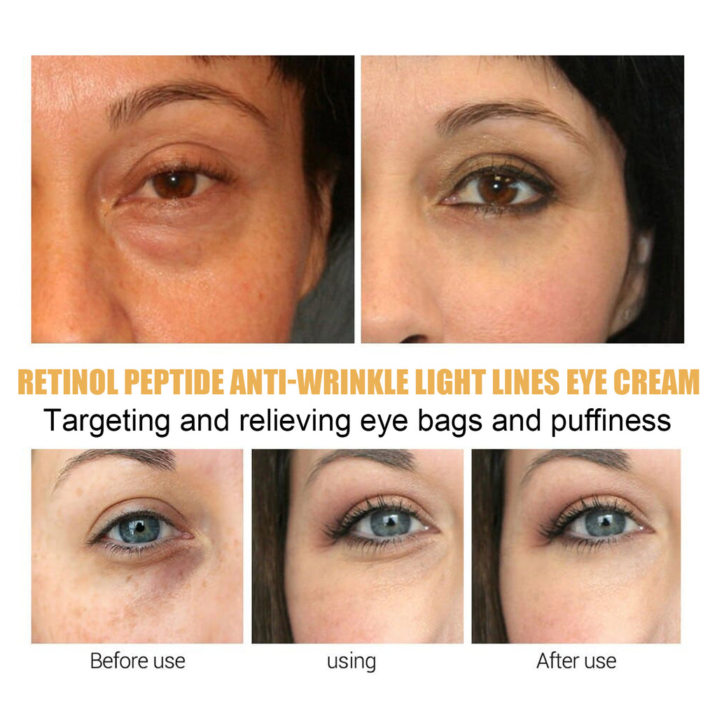 EELHOE Retinol Polypeptide Repair Eye Cream Firming And Fading Fine Lines Repair Anti-Aging Eye Cream