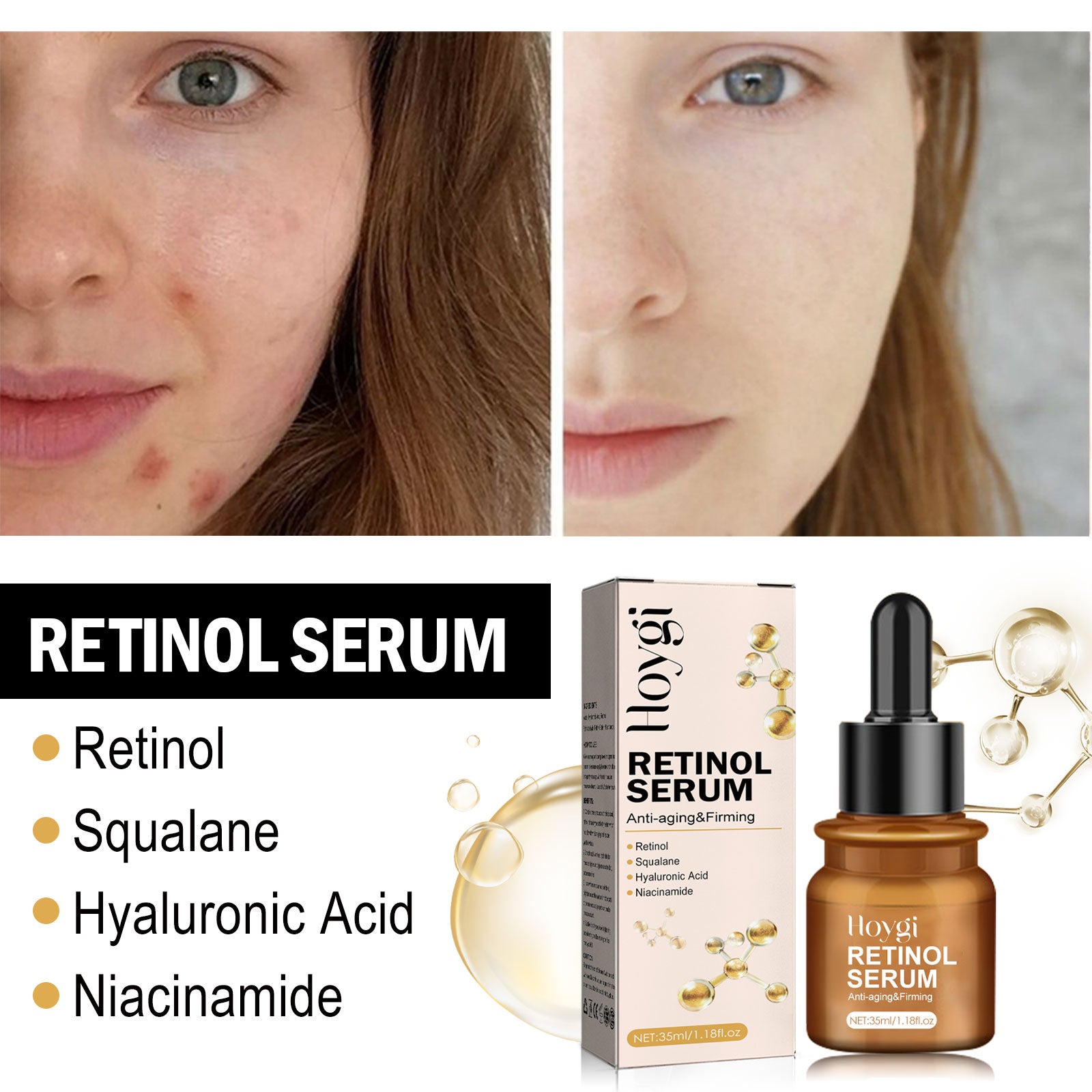 Retinol Firming Essence