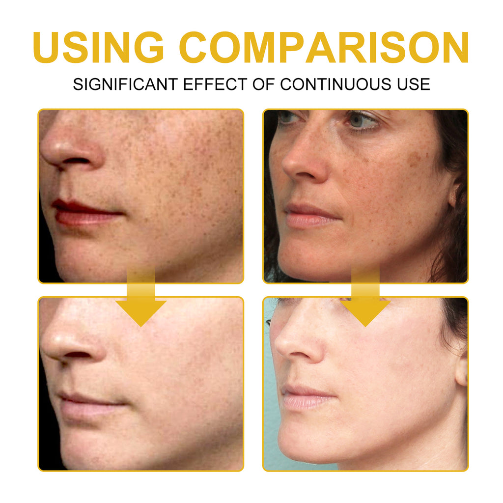 Wiyun V7 Whitening Cream Reduces Wrinkles And Fine Lines On The Face, Moisturizes And Brightens Skin, Anti-Aging And Replenishing Cream