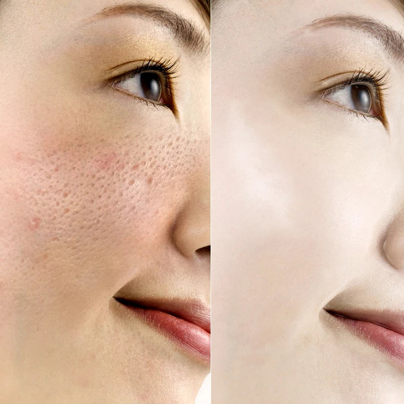VIBRANT GLAMOUR Hyaluronic Acid Face Serum Anti-Aging Shrink Pore Whitening Moisturizing Essence Face Cream Dry Skin Care 15ml