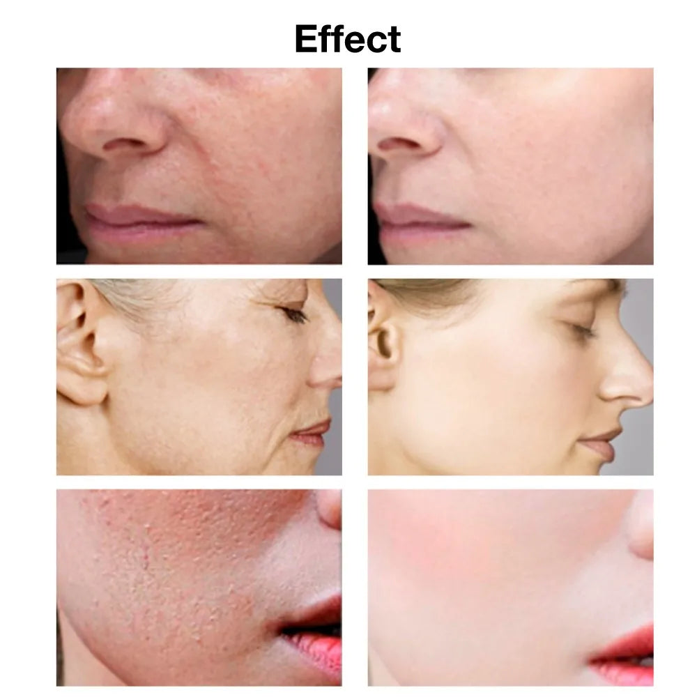 VIBRANT GLAMOUR Hyaluronic Acid Face Serum Anti-Aging Shrink Pore Whitening Moisturizing Essence Face Cream Dry Skin Care 15ml